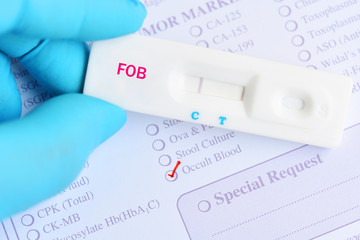 Fecal occult blood test (FOBT) negative by using rapid test cassette, colorectal cancer diagnosis - obrazy, fototapety, plakaty