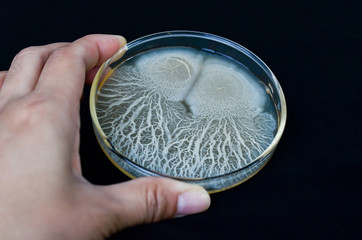 Beautiful bacterial colonies of Bacillus sp growing on agar plate