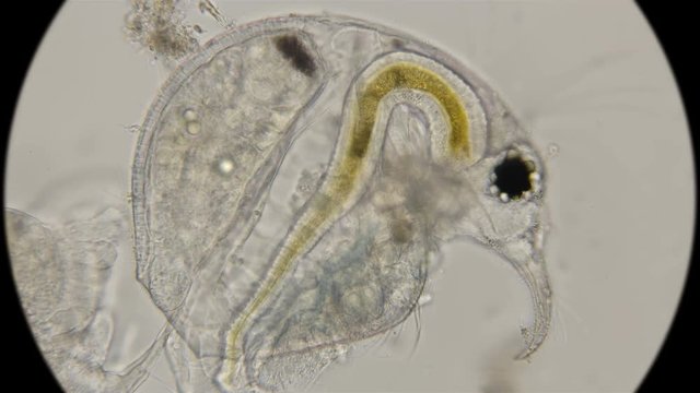 Bosmina water flea, under a microscope