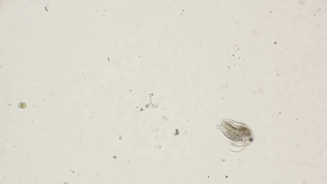 Bosmina water flea, under a microscope
