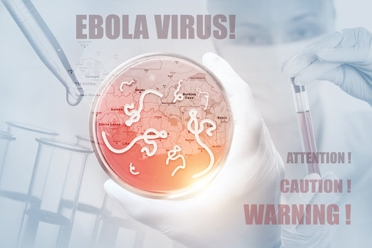 Microscopic view of the Ebola virus.