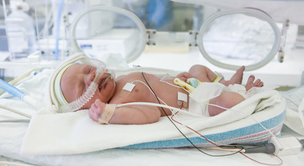 premature newborn baby in incubator