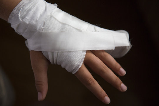 Mano con fasciatura e dito mignolo rotto