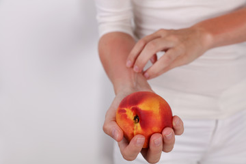 Woman suffering from Fruit Allergy holding a peach. OAS, food allergy symptoms rush, itching, skin...