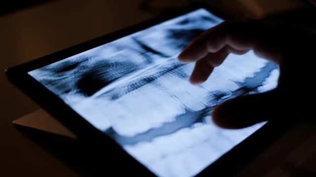 Doctor dentist analyzing teeth x-ray tommography medical data on touchscreen computer, work late at night, working with modern digital technologi in hospital concept