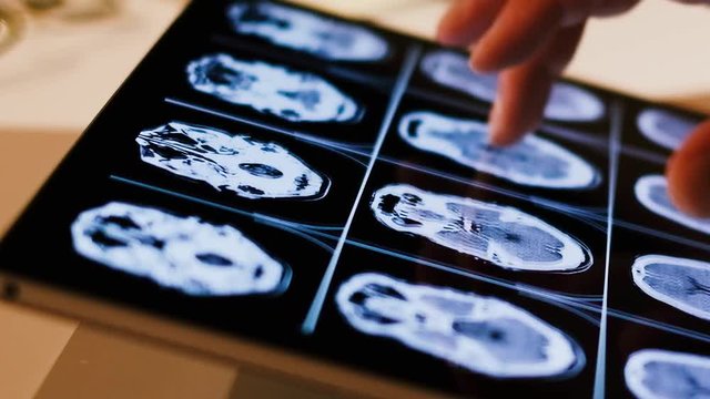Doctor analyzing skull brain x-ray tommography medical data on touchscreen computer, work late at night, working with modern digital technologi in hospital concept