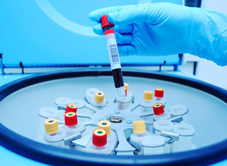 Medical laboratory centrifuge with test tubes with blood