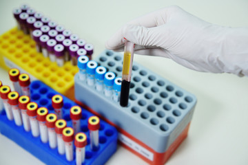 medical test tubes with blood tests on a laboratory background