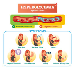 Hyperglycemia vector illustration collection set. Isolated symptom, diagnosis and signs as warning to disease and disorder. High blood sugar.