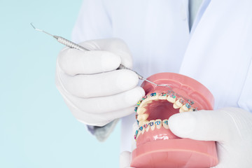 orthodontic model and dentist tool - demonstration teeth model of varities of orthodontic bracket...