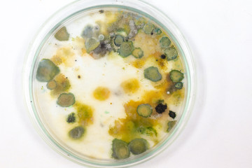 Backgrounds of Colony Characteristics of Fungus and algae in petri dish for education.