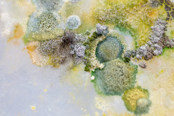Backgrounds of Colony Characteristics of Fungus and algae in petri dish for education.