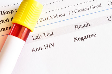 HIV negative test result with blood sample tube