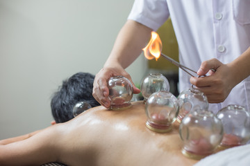 Traditional Chinese Medicine Treatment - Acupuncture - obrazy, fototapety, plakaty