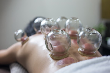 Traditional Chinese Medicine Treatment - Acupuncture