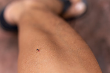 Close up of mosquito bite on human leg in the garden.