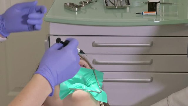 Woman at dentist clinic gets dental treatment to fill a cavity in a tooth. Dental restoration and composite material polymerization with UV light and laser. The doctor works with an assistant.