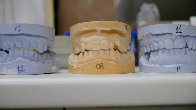 Gypsum models of teeth stand in a row on the table, camera movement. Molds in the dentists office, plaster jaws