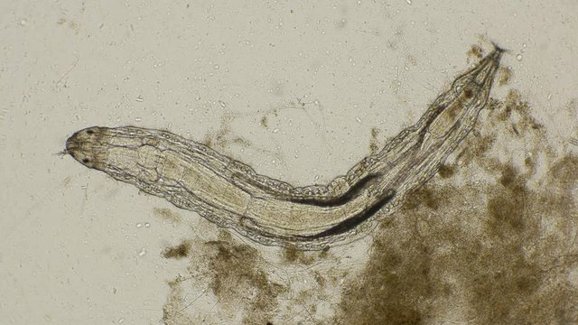 larva Chironomidae of lake midge or flies externally reminiscent of mosquitoes, under a microscope