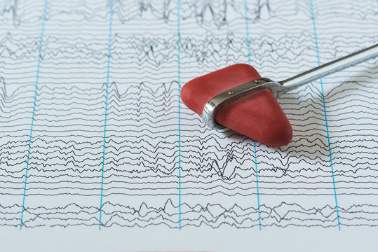 Concepts of neurological instrument on brain wave background