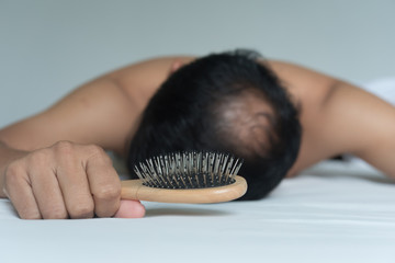 Asian man   are worried   with hair loss problem on the bed at home.