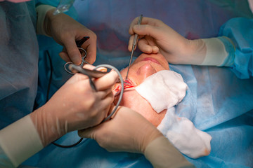 Plastic surgery in the operating room. Blepharoplasty