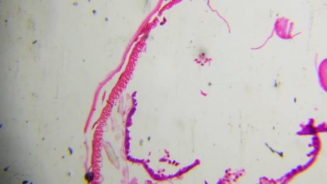 Ascaris female, cross section, magnified 100 times through a microscope