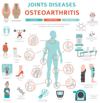 Joints diseases. Arthritis, osteoarthritis symptoms, treatment icon set. Medical infographic design