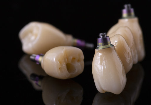 Tooth human implant. Dental concept. Ceramic human teeth or dentures. Implants on black background closeup