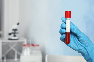 Doctor holding glass tube with blood sample indoors. Allergy test