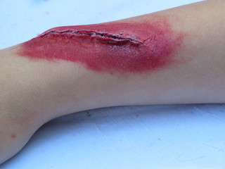 Heavy wound on a human hand. Bloody wound makeup special effect