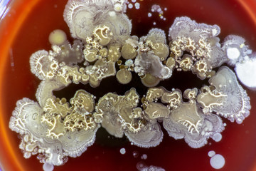 Mold growing in a Petri dish