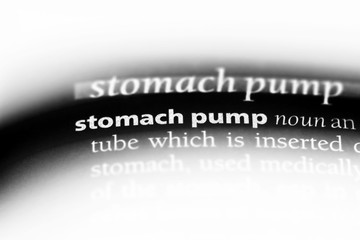 stomach pump