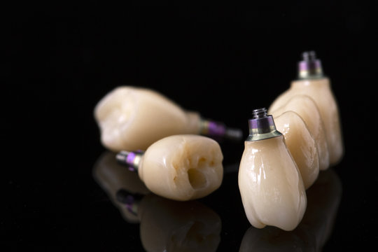 Tooth human implant. Dental concept. Ceramic human teeth or dentures. Implants on black background closeup