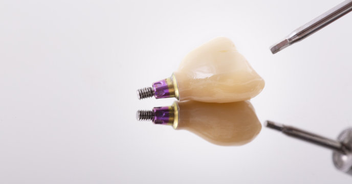 Tooth human implant. Dental concept. Ceramic human teeth or dentures. Implants on mirror background closeup