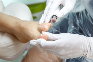 Medical pedicure for a woman