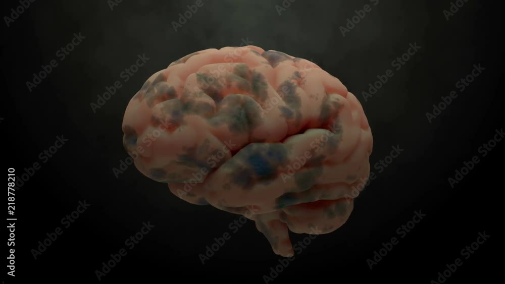 Poster 3d render of brain with damage zones. infection or another reason of brain damage concept. animation