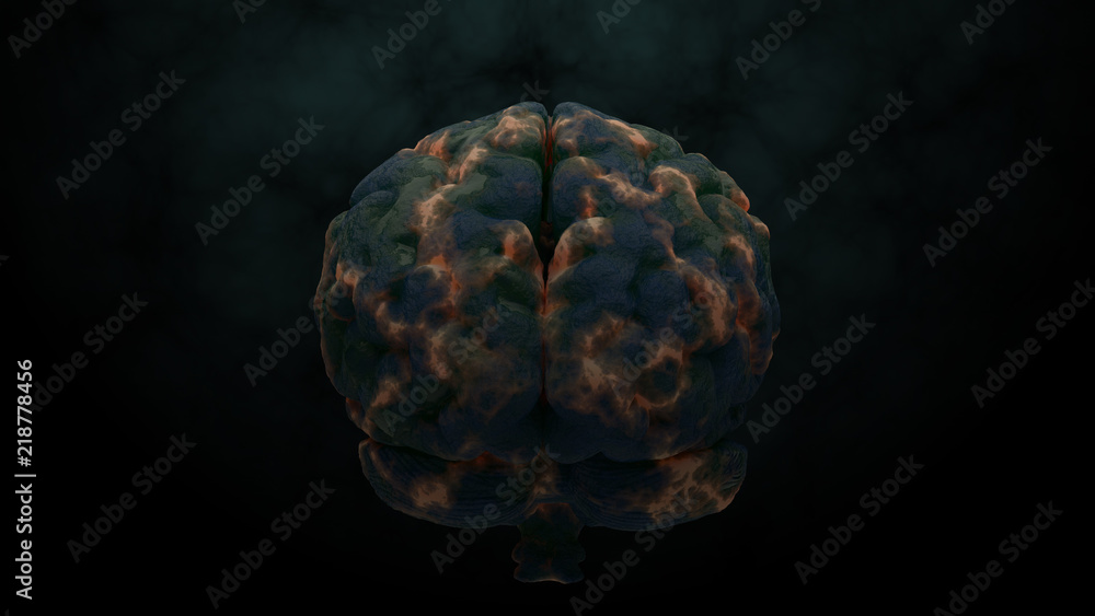 Poster 3d render of brain with damage zones. infection or another reason of brain damage concept.