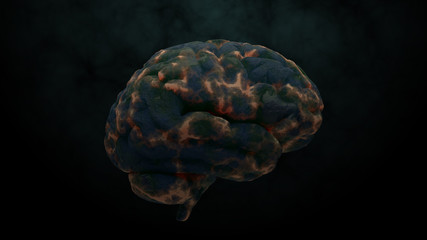 3d render of brain with damage zones. Infection or another reason of brain damage concept.