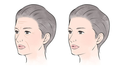 シワのある女性、ない女性