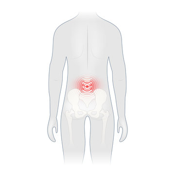 recommend clip art: Back pain