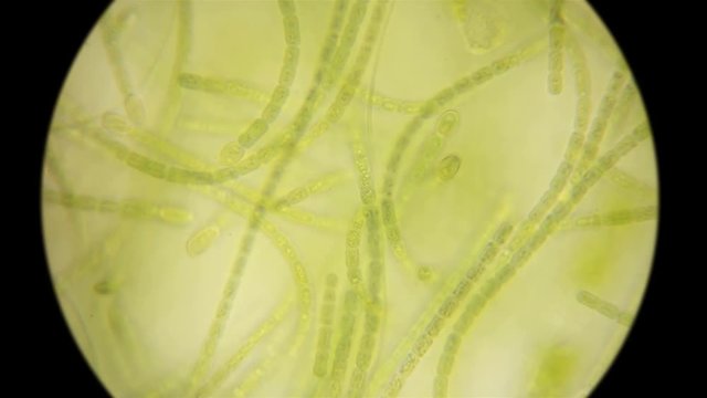 movement of live algae under a microscope