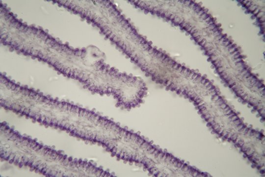 Coprinus mushroom under the microscope