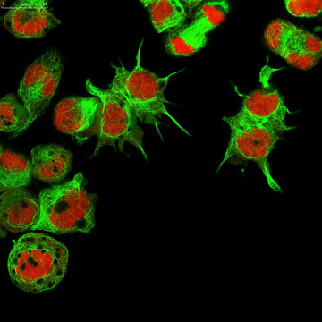Real Fluorescence Microscopic View Of Human Neuroblastoma Cells