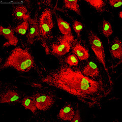 Mitochondria staining