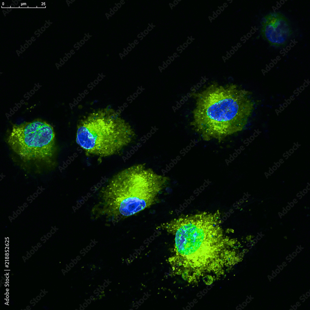 Sticker confocal microscopy of mesenchymal stem cell