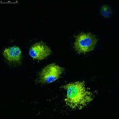 Fototapeta na wymiar Confocal microscopy of mesenchymal stem cell