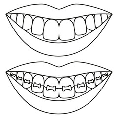 Line art black and white teeth aligning concept