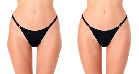 Closeup shot of female thighs before and after treatment, isolated on white background