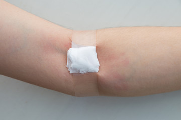 woman hand with cotton alcohol closed on arm after blood donation on white